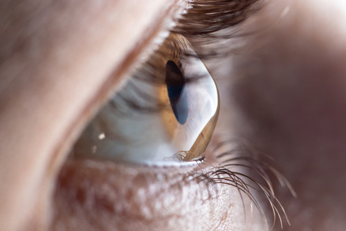 keratoconus eye disease treatment